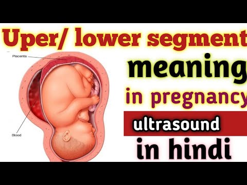Upper segment/Lower segment meaning in pregnancy ultrasound in hindi! #
