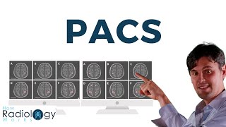 PACS (What is Picture Archiving and Communications System)