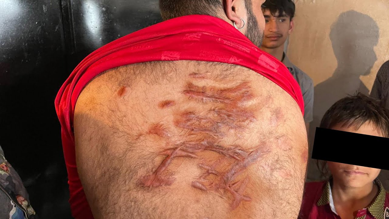 La tradición religiosa más dolorosa: Ashura | Cuchillos y golpes por el Islam La tradición religiosa más dolorosa: Ashura | Cuchillos y golpes por el Islam