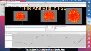 Finite Impulse Response (FIR) Analysis in FSL