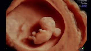 Kako izgleda beba u osmoj nedelji trudnoce -Utvrdjivanje trudnoce screenshot 2