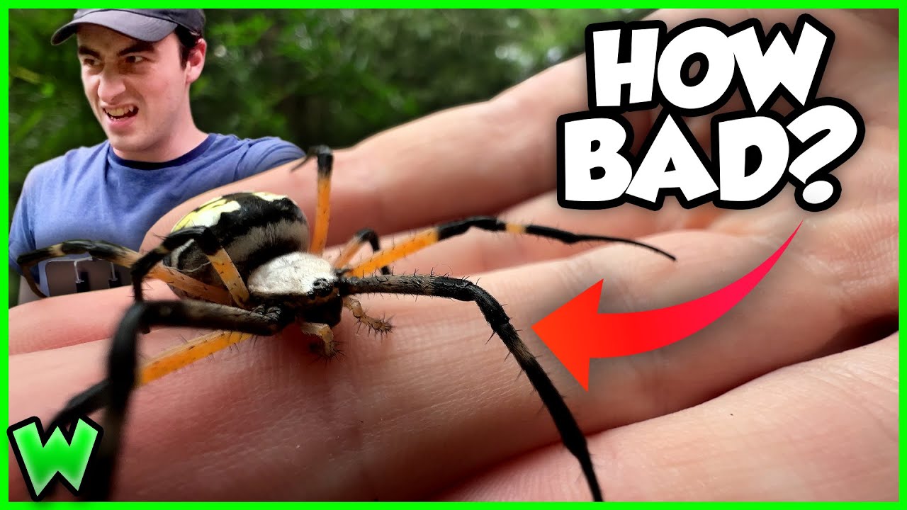 Garden Spider BITE! Is it Dangerous? 