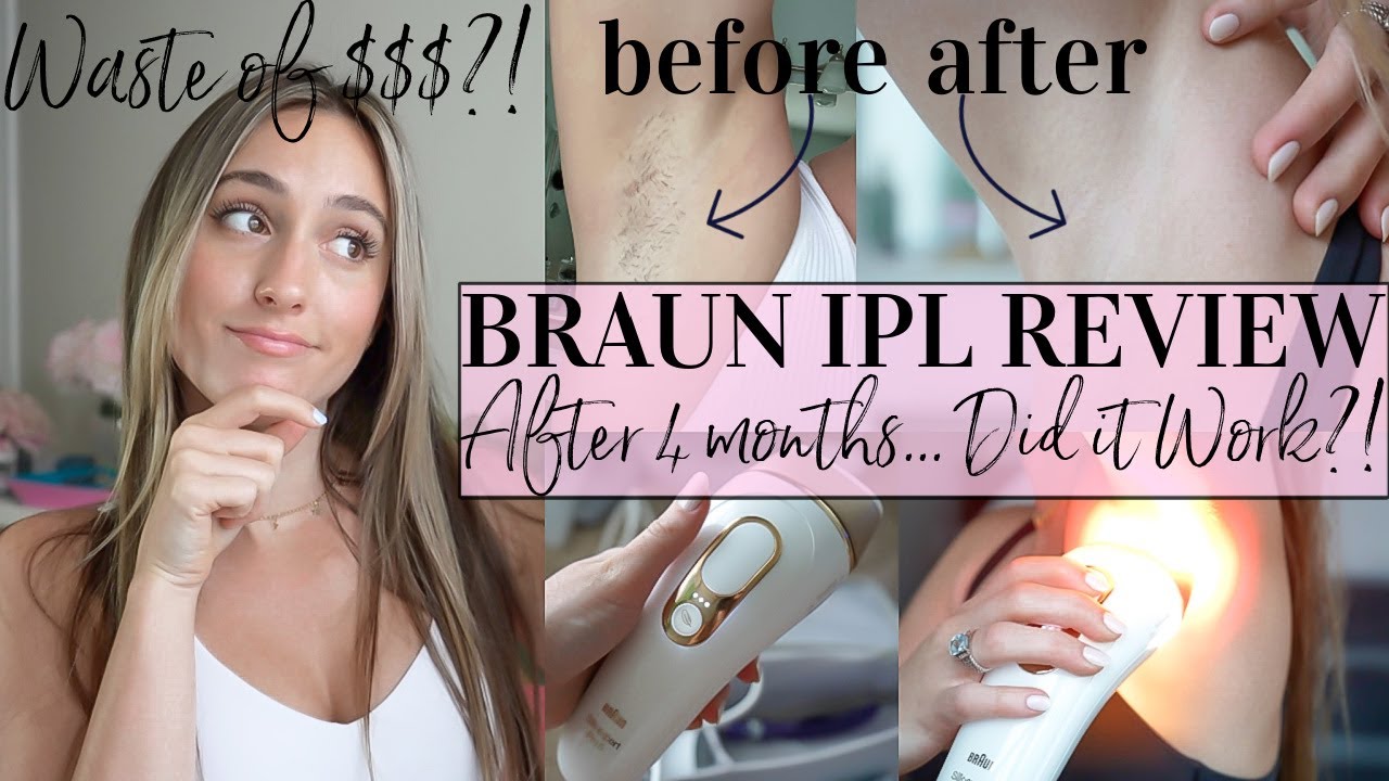 BRAUN IPL REVIEW//DID IT WORK?!//4 months later//Hair Removal Review &  Tutorial 