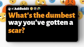 r/AskReddit | What's the dumbest way you've gotten a scar?
