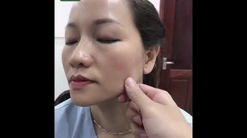 🔴 Nâng mũi + Cắt mi 👉 combo hoàn hảo giúp nâng cấp diện mạo