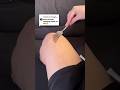 Мій топововий засіб з Аврора #recare #точковийкрем #врослеволосся