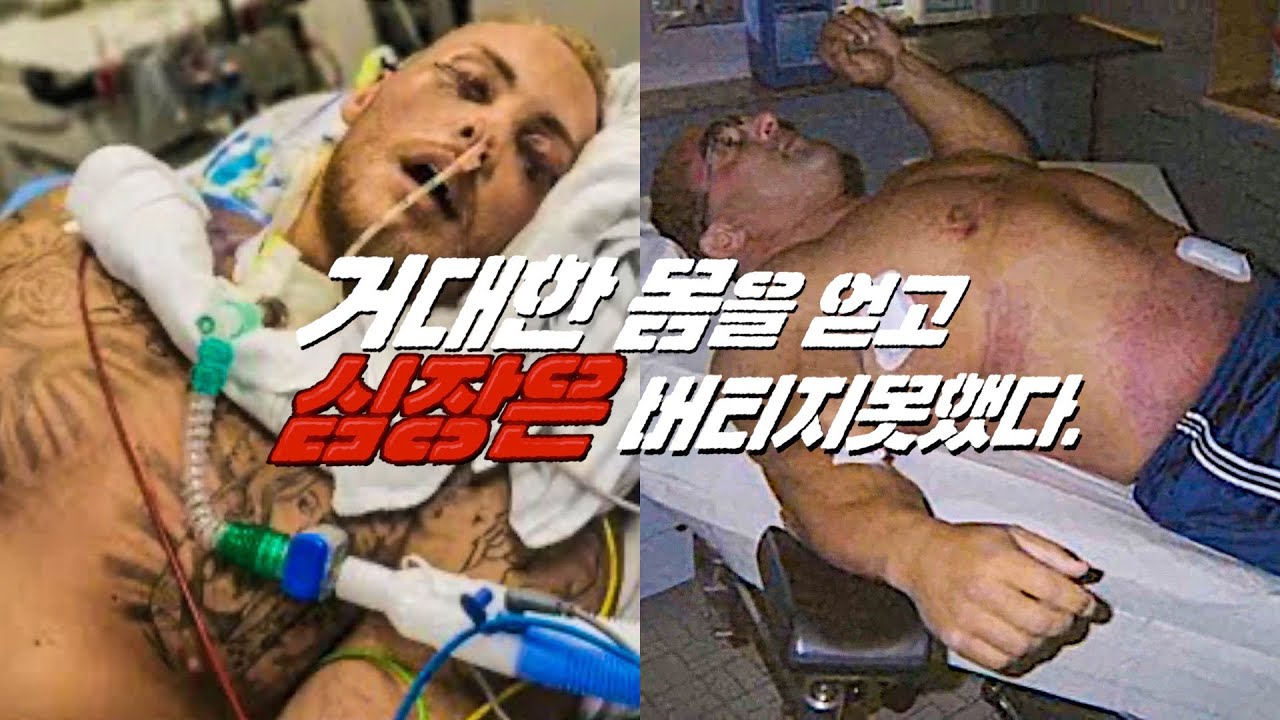 거대한몸과 거대하지않은 심장 (벌크업에 대하여)