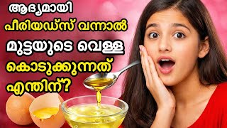 ആദയമയ പരയഡസ വനനൽമടടയട വളള കടകകനനത എനതന?