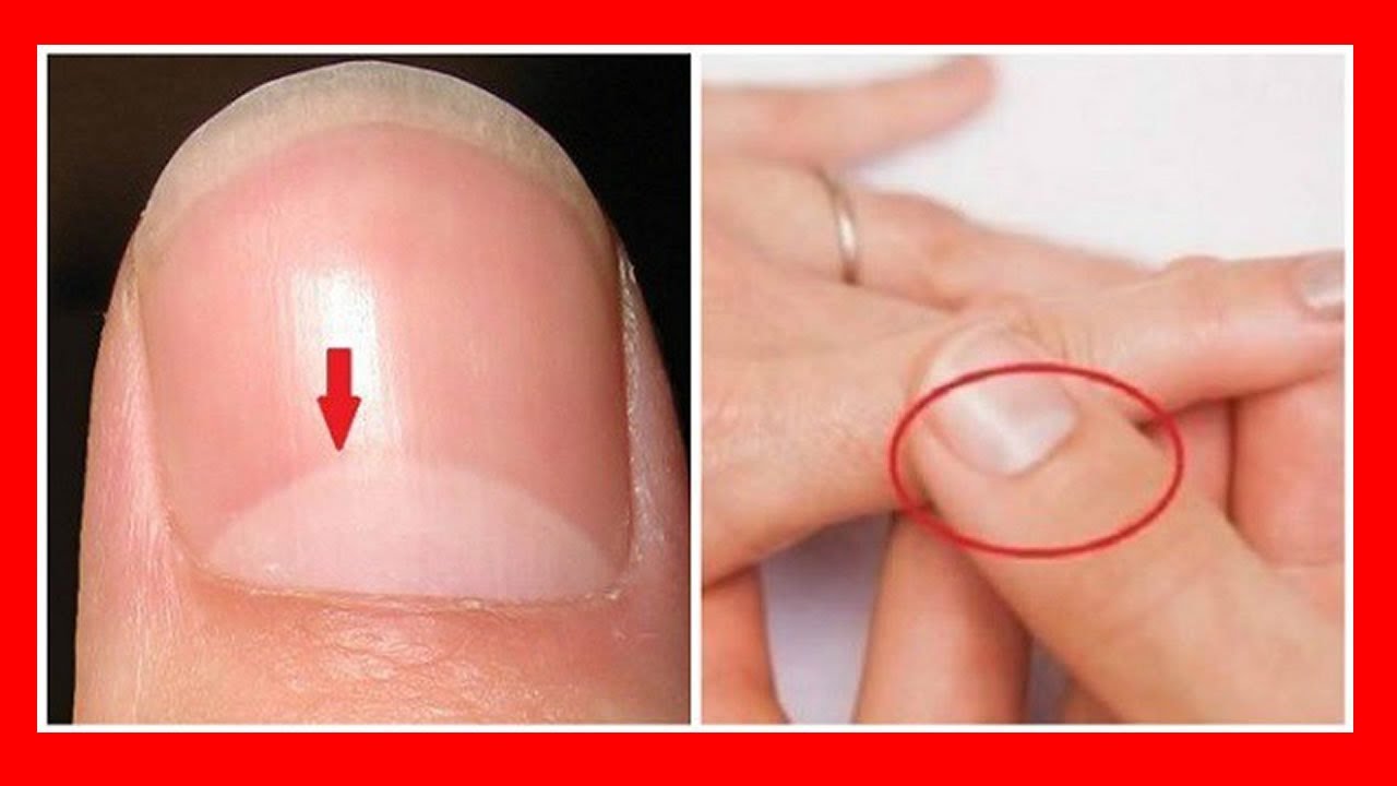 Esto Es Lo Que Dice La �Media Luna� De Tus U�as Sobre Tu Salud | Mejor Salud