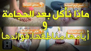 ماذا نأكل بعد الحجامة وكل المعلومات عن أيامها ومجالاتها وفوائدها على اليوتيوب