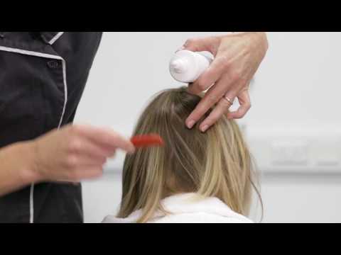 Treating scalp psoriasis