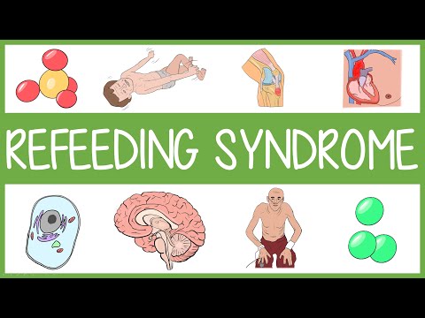 ቪዲዮ: Refeeding Syndrome አለብኝ?