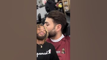 AMAZING Beard Bald Spot Transformation #shorts