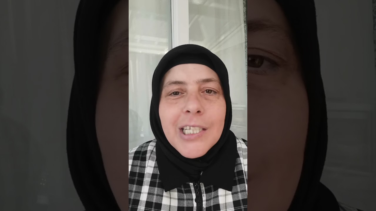 Yüz Felcinde 7. Gün | Facial Paralysis Day 7