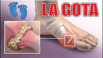 ¿Cuáles son los problemas habituales del dedo gordo del pie?
