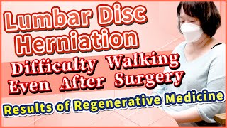 【Lumbar Herniated Disc】Difficulty Walking After Surgery -Improvement through Stem Cell Therapy