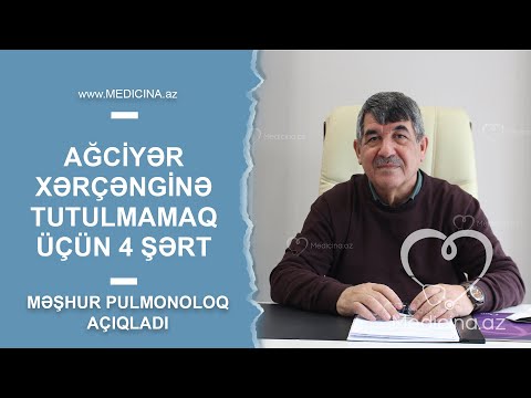 Video: Mətbəxin Içindəki Işıqlar: Xüsusiyyətləri, Yerləşdirmə Qaydaları, Foto