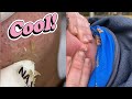 Explosive pimple pooping  ultimate pimple popping compilation