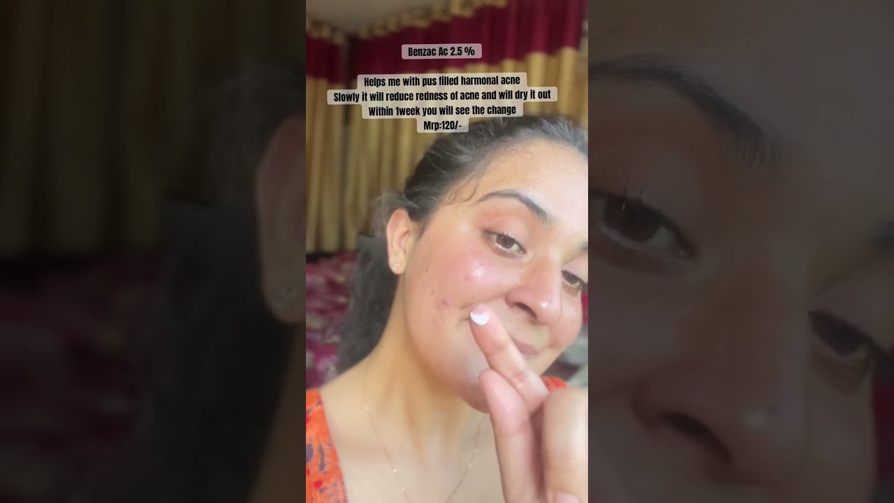 Benzac Ac 2.5% 