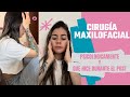 Mis 6 etapas psicológicas de la Post cirugía maxilofacial