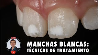 Manchas blancas: Técnicas de tratamiento