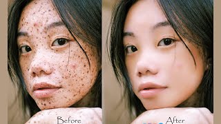 Mastering High-End Skin Retouching in Adobe Photoshop 7.0 | Professional Beauty Editing Tutorial