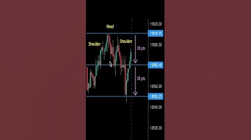 Head and Shoulders Chart pattern | Intraday | #priceaction #chartpatterns #intradaytamil #tamilshare