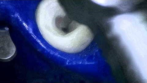 DENTSPLY UK SDR Retrieval