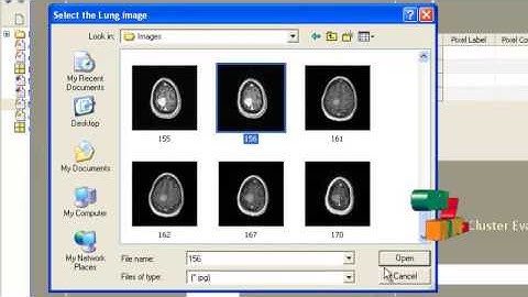 Final Year Projects | MRI BRAIN IMAGE SEGMENTATION USING MODIFIED FUZZY CMEANS CLUS