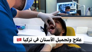 تجربة تجميل وعلاج الاسنان في تركيا 🇹🇷