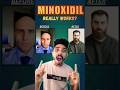 Reality of Minoxidil 🤯... #drugsafety #healthindia #science #healthtipsindia