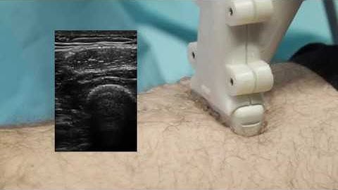 Use the Force: Deformation Correction in Robotic 3D Ultrasound