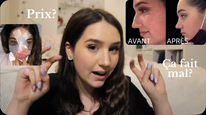 MA RHINOPLASTIE - Vlog, Expérience, Prix, Conseils