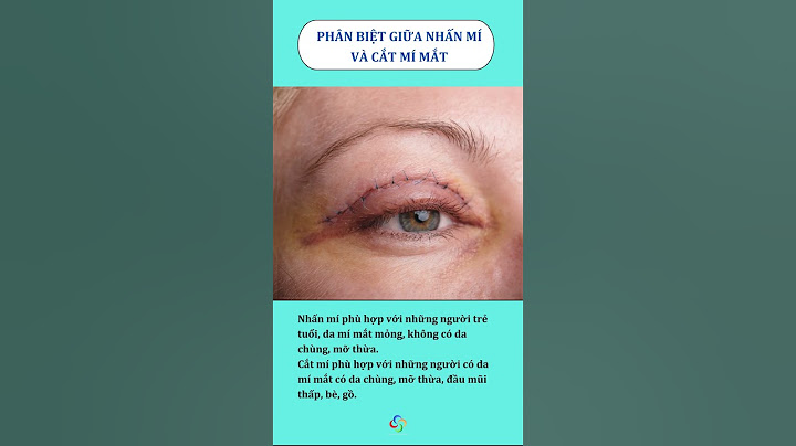 ✴️ PHÂN BIỆT GIỮA NHẤN MÍ VÀ CẮT MÍ MẮT