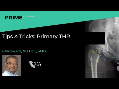 Tips &amp; Tricks: Primary THR - Gavin Pereira, MD, FRCS, FAAOS