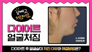 다이어트 얼굴처짐 원인 및 리프팅 방법은 무엇? #노블와이성형외과
