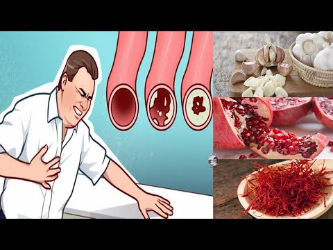 Video: 10 Ushqime Për Të Pastruar Arteriet Tuaja