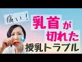【乳首】痛い！息子に噛まれた！治るまでの体験談と対処法６つ【授乳トラブル】切れないための対策４つもご紹介しています