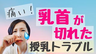 【乳首】痛い！息子に噛まれた！治るまでの体験談と対処法６つ【授乳トラブル】切れないための対策４つもご紹介しています