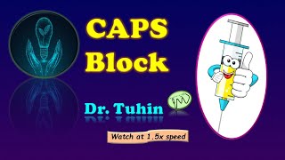 CAPS Block | Popliteal Sciatic Nerve Block Lateral Approach | Popliteal Fossa Block | @DrTuhinM