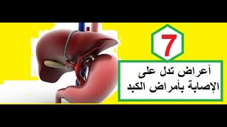 7   أعراض تدل على الإصابة بأمراض الكبد ؛؛؛ فما هى ؟؟؟