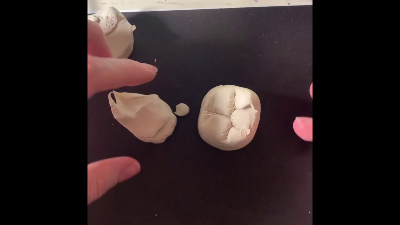 Первый моляр н/ч (1)