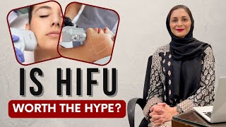What No One Tells You About HIFU! Watch Before You Try