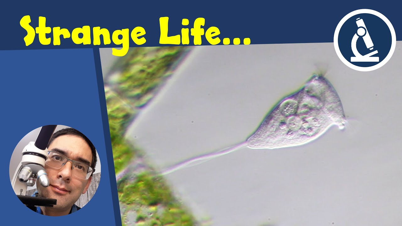 🔬 150 - What's a Vorticella? | Amateur Microscopy