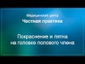 Покраснение и пятна на головке полового члена