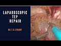 Lap tep repair