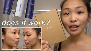 ONE WEEK USING CUROLOGY | MY EXPERIENCE | UNSPONSORED REVIEW