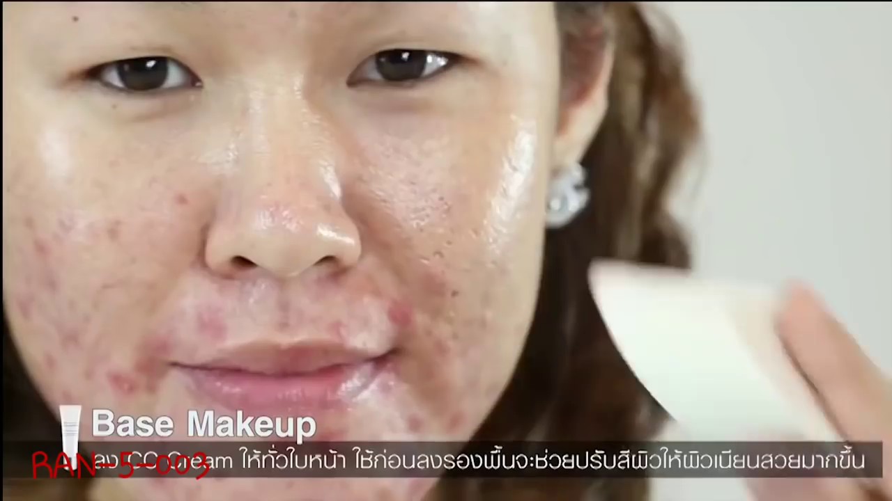 เทคนิคการกลบรอยแดงจากสิว by น้องฉัตร สิวเห่อแค่ไหนเครื่องสำอางก้ช่วยคุณได้