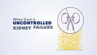 Gout & Kidney Disease 101