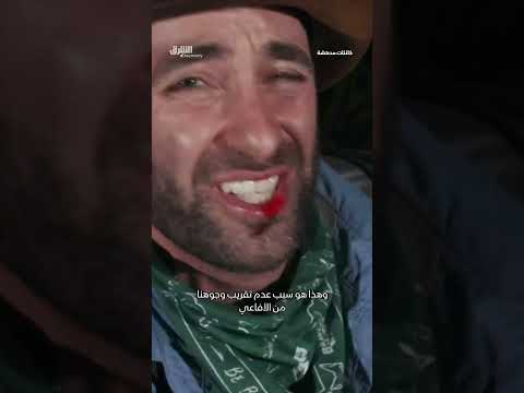 لسعة أفعى غير متوقعة